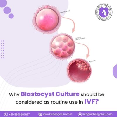 Why blastocyst culture should be considered as routine use in IVF